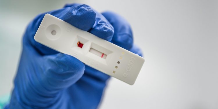 testele-antigen,-de-ajuns-pentru-a-depista-covid-19.-medic-infectionist:-„ar-trebui-efectuate-intr-o-unitate-medicala-pentru-a-sti-ca-a-fost-recoltat-corect”