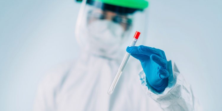 bilantul-zilei-156-de-cazuri-noi-de-coronavirus,-depistate-in-ultimele-24-de-ore.-numarul-deceselor