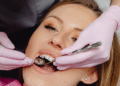 Când poate fi salvat un dinte? Rolul endodonției moderne și al microscopului dentar